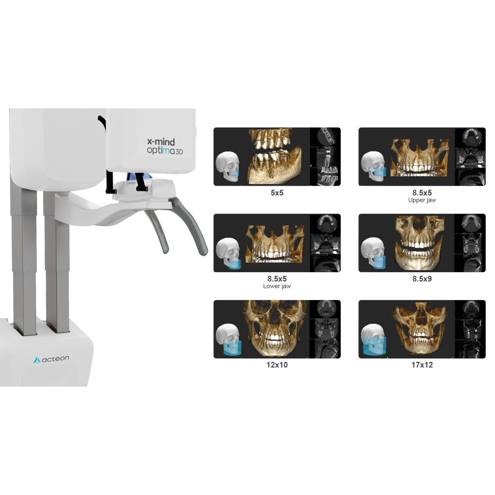 Рентгеновская система X-MIND Optima 3D (CBCT) Acteon